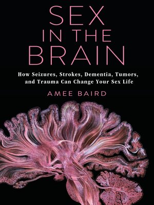 cover image of Sex in the Brain